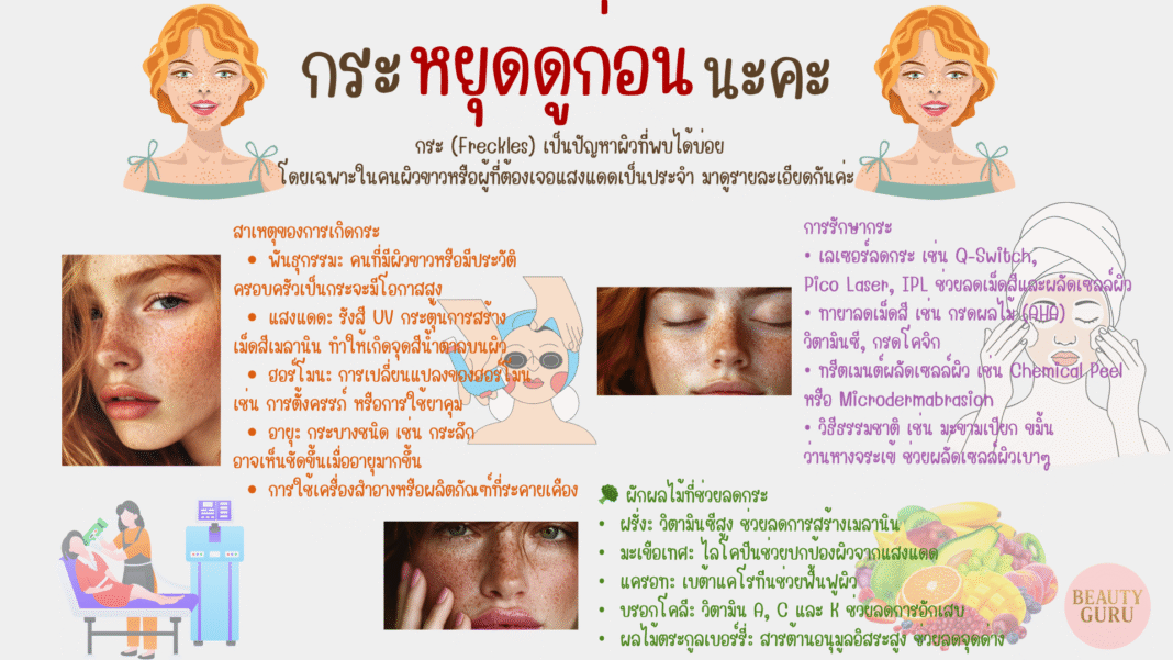 กระ!!! เกิดจากอะไร?